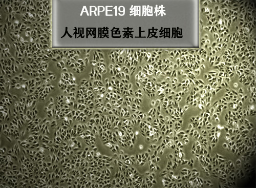 人視網(wǎng)膜色素上皮細胞 ARPE19