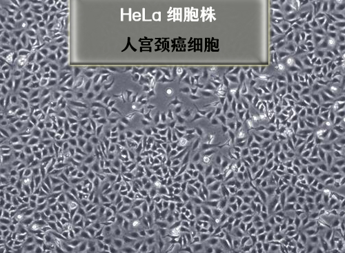 人宮頸癌細胞-HeLa?細胞