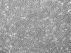 HyCyte 人脂肪間充質(zhì)干細胞