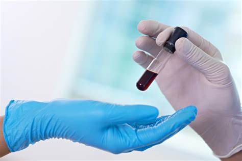 <i style='color:red'>southern</i> Blot實驗原理及步驟詳解