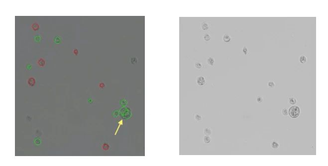 傳統(tǒng)方法細胞計數(shù)