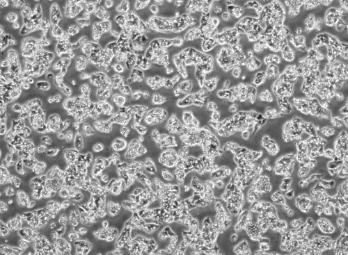 HEP-G2人肝癌細胞