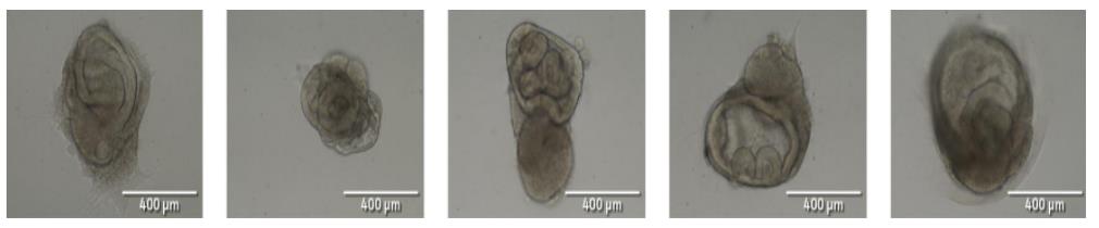 低內(nèi)毒素 <i style='color:red'>gelnest</i> 基質(zhì)膠在類器官構(gòu)建中的關(guān)鍵應(yīng)用 —為微生物污染敏感實(shí)驗(yàn)筑牢安全防線