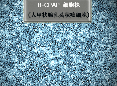 B-CPAP細胞