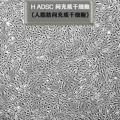 間充質(zhì)干細(xì)胞的特點及應(yīng)用經(jīng)驗分享