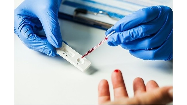 <i style='color:red'>poct</i>-新技術(shù)或?qū)⒁I(lǐng)-實(shí)驗(yàn)室儀器設(shè)備革新?lián)Q代