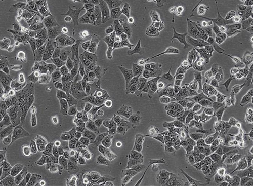 MHCC97H-?人肝癌細胞?