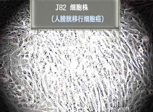 J82細胞