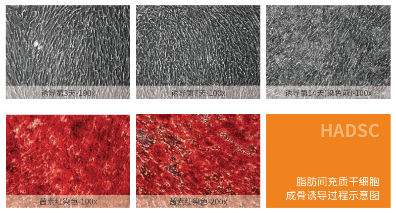 脂肪間充質(zhì)干細(xì)胞誘導(dǎo)