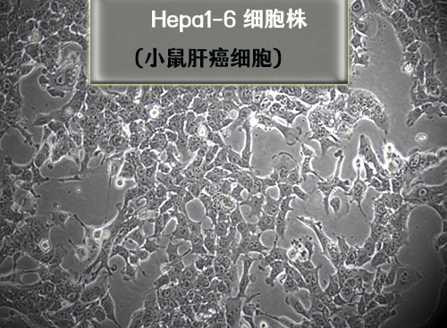 hepa1-6細胞